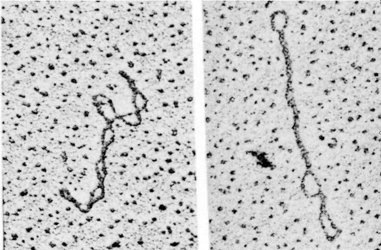 The blueprint of life [4]: Tertiary Structure of DNA